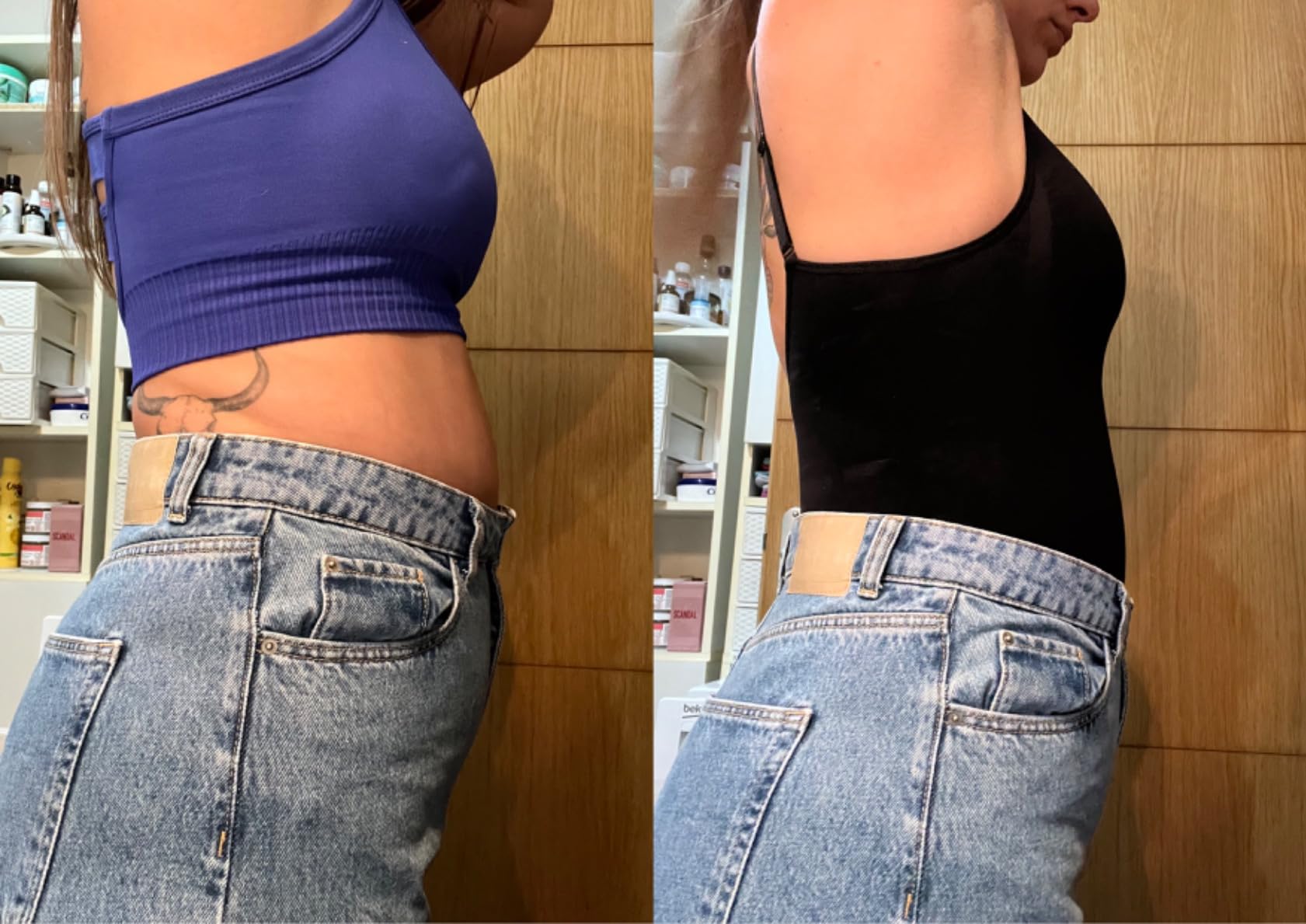 files/Laurie_Avant_Apres.jpg